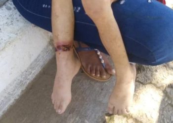 Detienen pareja por maltrato contra hija de seis años