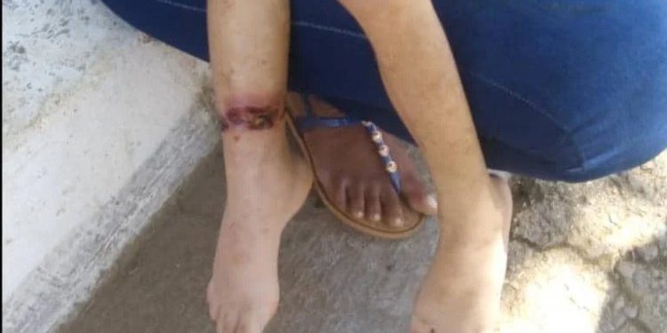Detienen pareja por maltrato contra hija de seis años