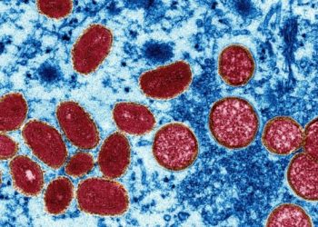 Alertan ante posibles mutaciones del patógeno de la viruela del mono