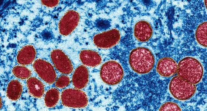 Alertan ante posibles mutaciones del patógeno de la viruela del mono