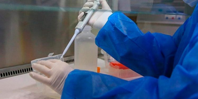 Se confirma el primer caso de viruela del mono en Rusia