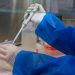 Se confirma el primer caso de viruela del mono en Rusia