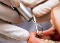 Ministerio Público imputa a personas por ejercicio ilegal de la odontología y medicina