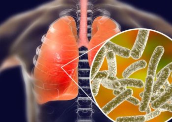 Bacteria legionella causa brote de neumonía con 4 muertos en Argentina