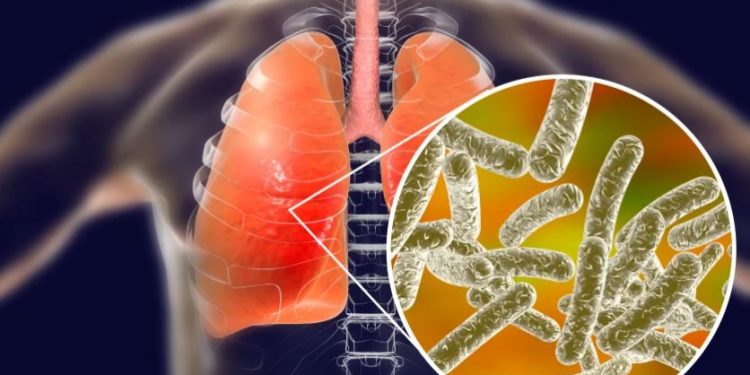 Bacteria legionella causa brote de neumonía con 4 muertos en Argentina