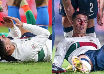 Ronaldo termina ensangrentado tras sufrir un duro golpe en la nariz durante un partido