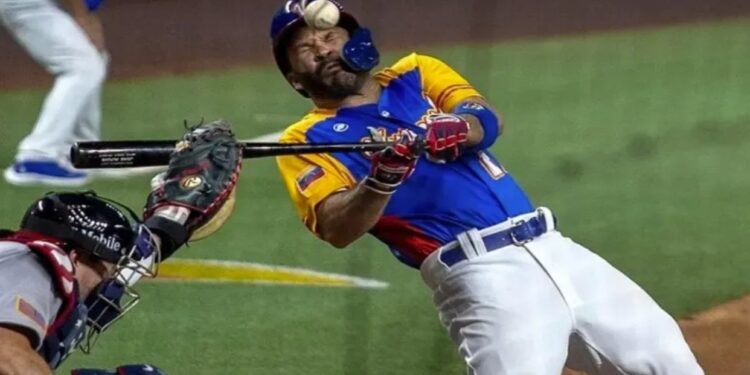 Altuve fue operado con éxito y estará fuera del campo al menos dos meses